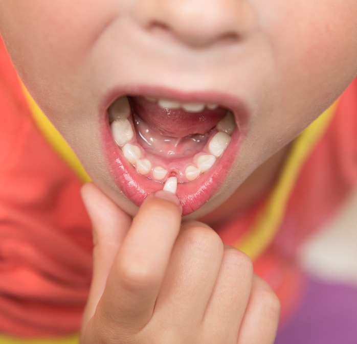 Gentle wiggling the tooth using fingers