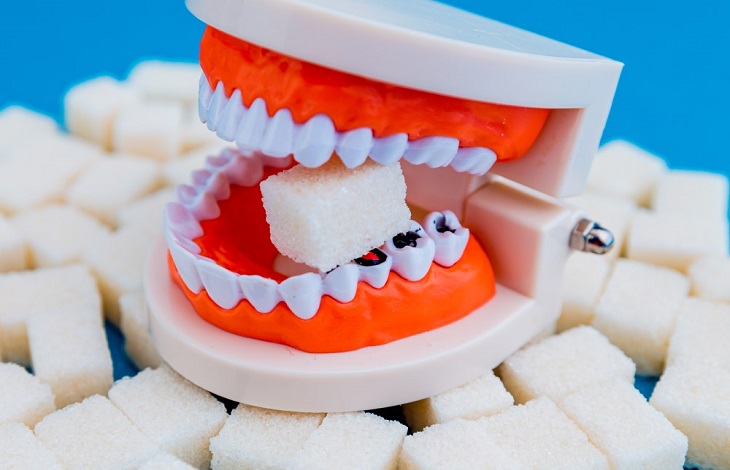 How Diet Affects Your Teeth: Sugary and Acidic Foods