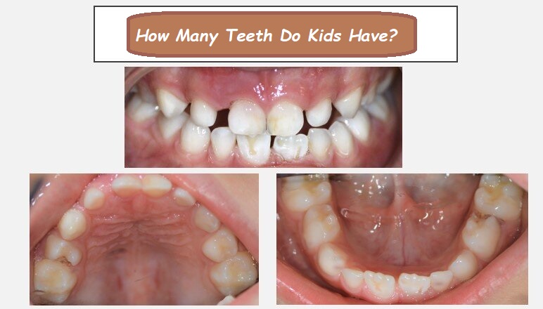 How Many Teeth Do Kids Have? A Complete Guide to Baby Teeth and Molars in Children