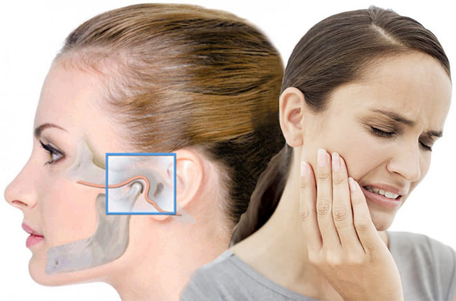 TMJ- The joint between upper and lower jaw can have disorder causing Jaw popping 