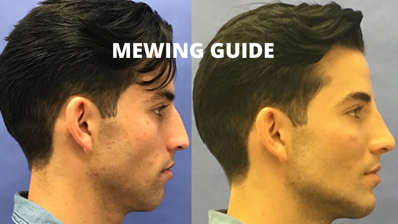 The Ultimate Guide to Mewing: What It Is, How to Mew Properly, and Why It's Gaining Popularity