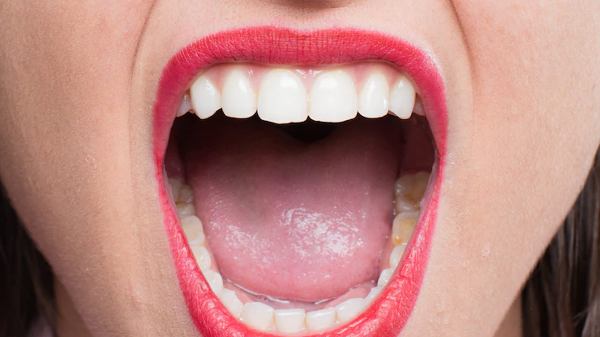 Why Is My Mouth Producing So Much Saliva Suddenly? Causes, Remedies, and When to Seek Help