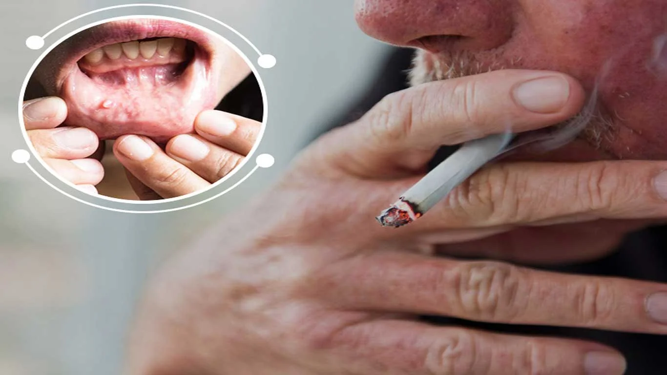 How Tobacco and Alcohol Increase Your Risk of Mouth Cancer