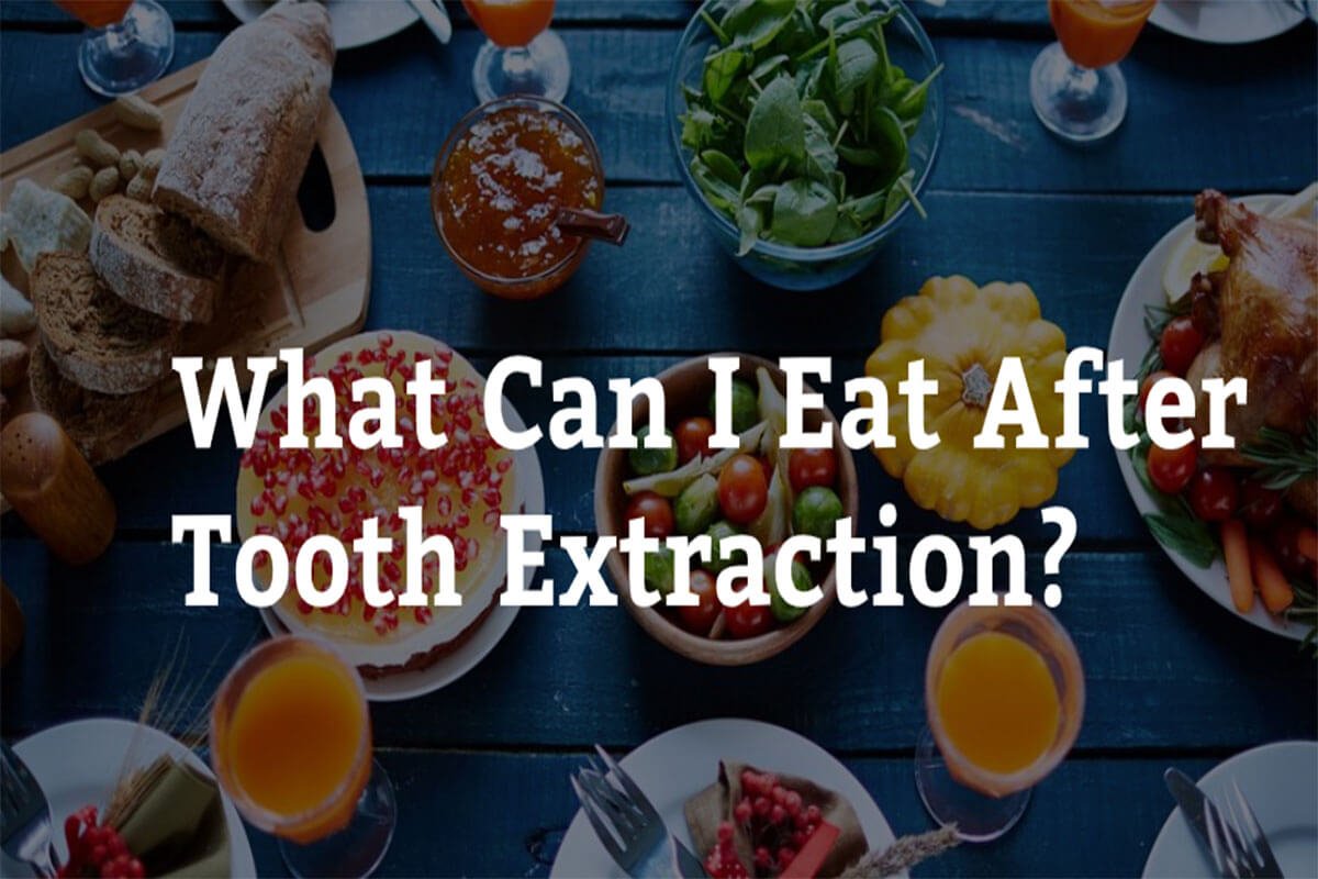 What can i eat after tooth extraction