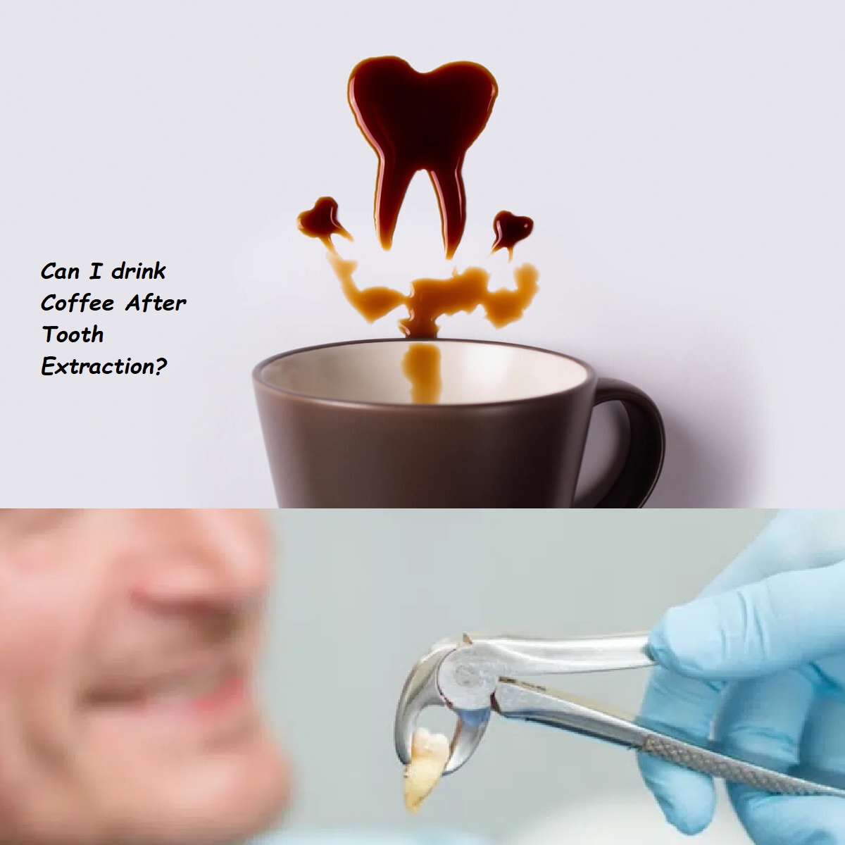 Can I Drink Coffee After Tooth Extraction? What You Need to Know About Caffeine After Oral Surgery