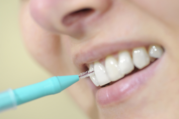 Interdental-Brush is best to remove something stuck in gums