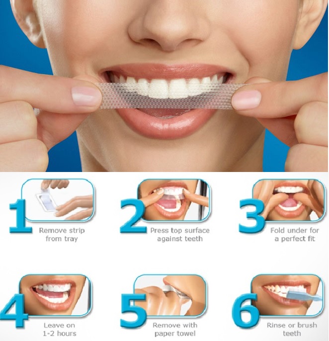 Proper Usage of Whitening Strips: Achieve a Brighter Smile Safely and Effectively