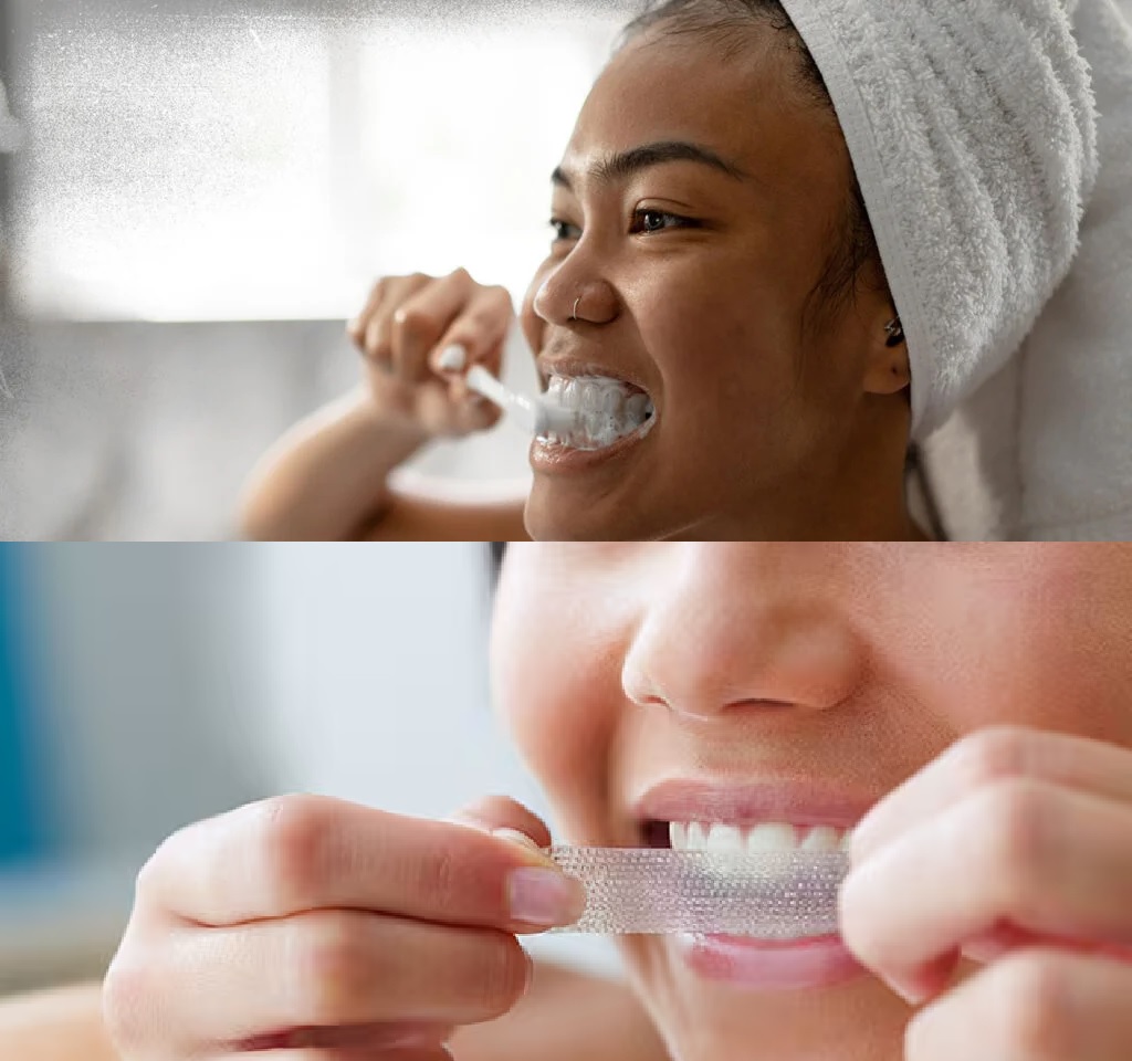 Should I Brush My Teeth Before or After Using Whitening Strips? Your Ultimate Guide to Brighter Teeth