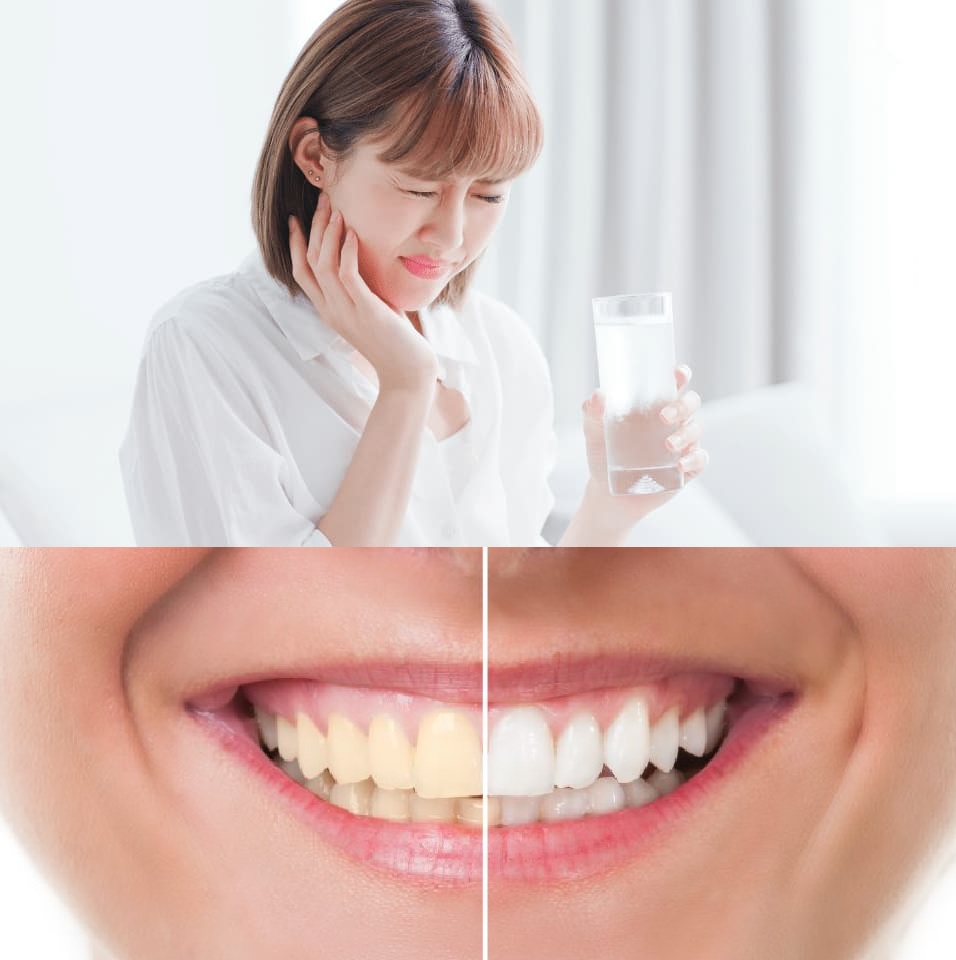 Tooth Sensitivity After Whitening Treatments: Causes, Prevention, and Solutions