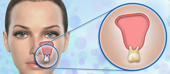 sinus relation to when all of teeth hurt suddenly. all my teeth hurt suddenly sinus